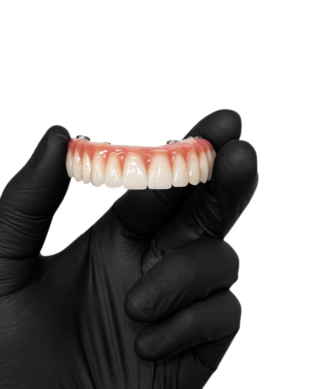 Full-Arch Implant  -  frameworks